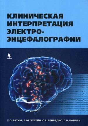 Клиническая интерпретация электроэнцефалографии | Clinical Interpretation of Electroencephalography