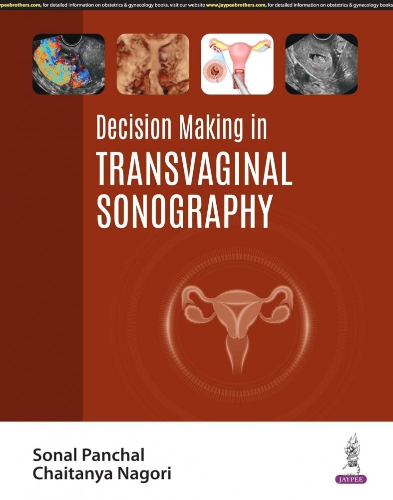 Принятие решений в трансвагинальной сонографии | Decision Making in Transvaginal Sonography