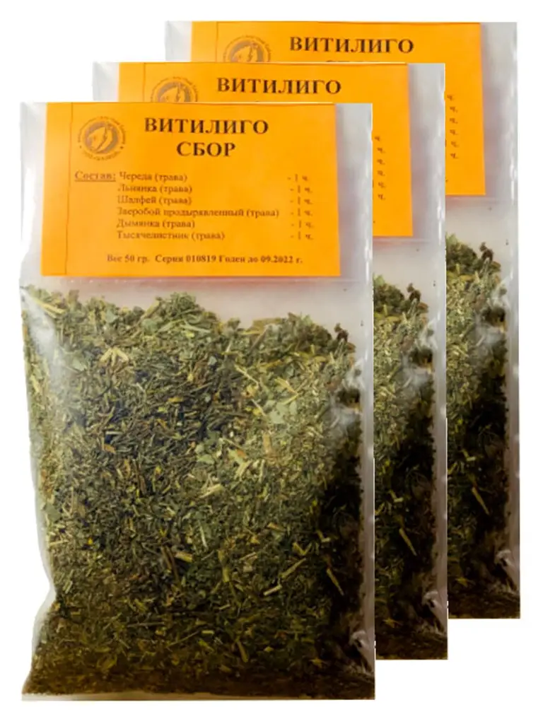 150g Vitiligo Treatment: Skin Nutrition &amp; Healing Course