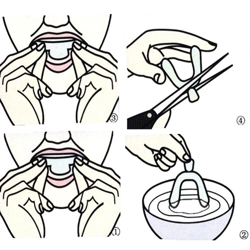 4 pcs Silicone Dental Night Guard for Bruxism – Universal Thermoplastic #14