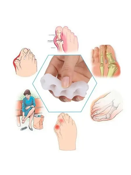 5-Toe Separators: 1 Pair