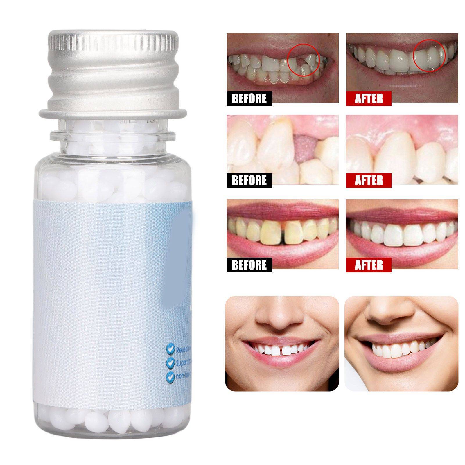 Lieviry Denture Repair Beads - 5 ml Fixing Cream for Temporary Tooth Restoration #11