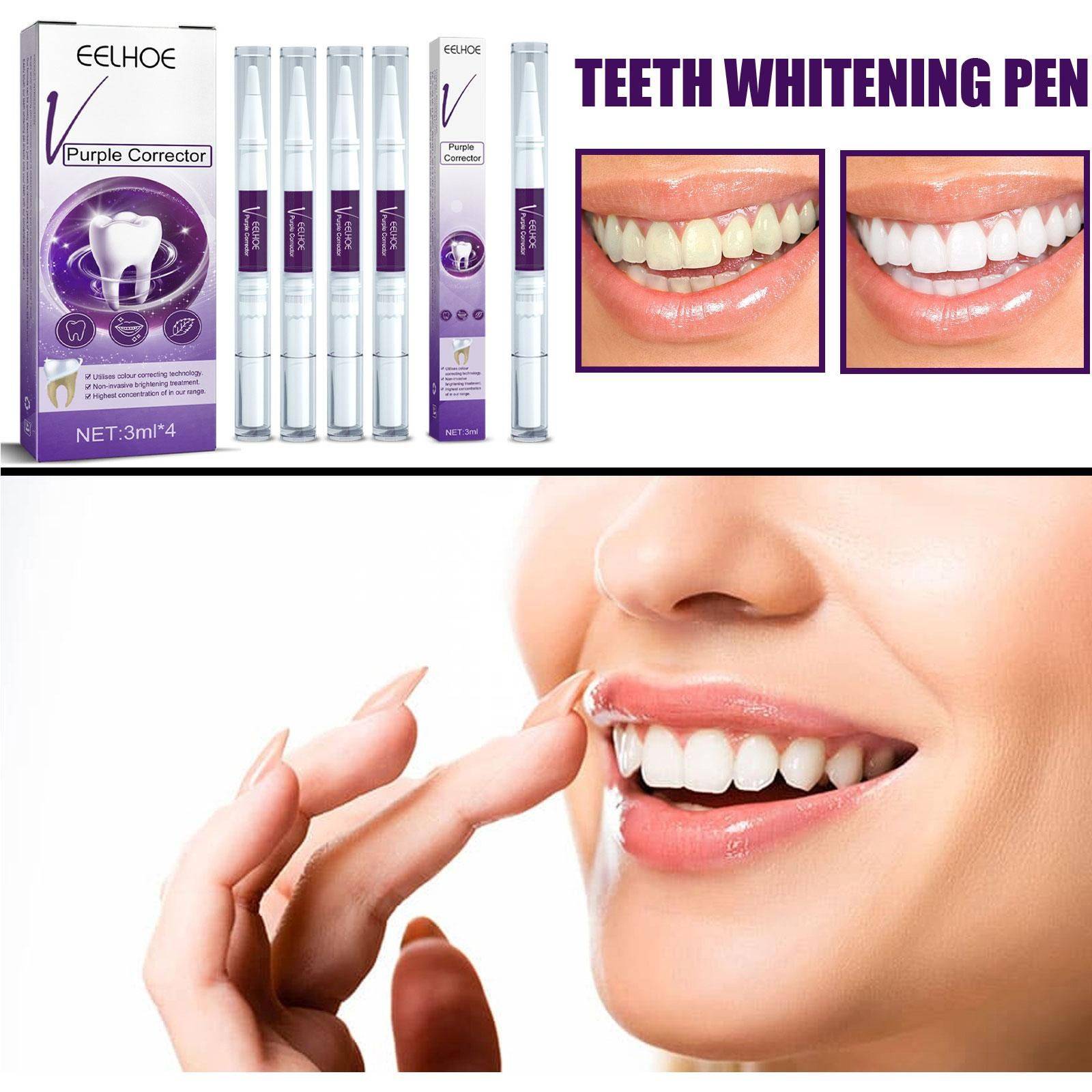 Whitening Pencil for Teeth – Anti‑Pigmentation Gel, 3 ml #4