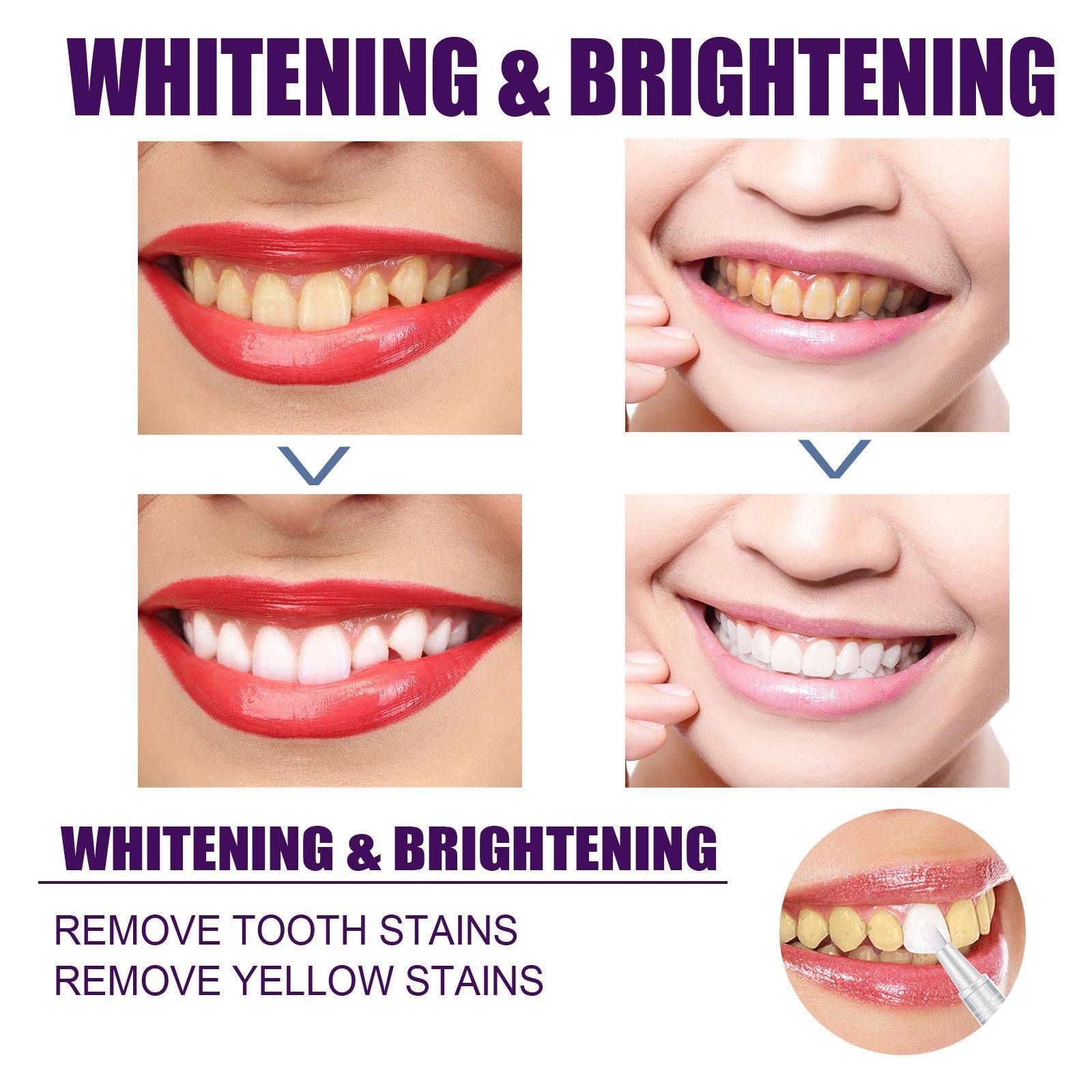 Whitening Pencil for Teeth – Anti‑Pigmentation Gel, 3 ml #13