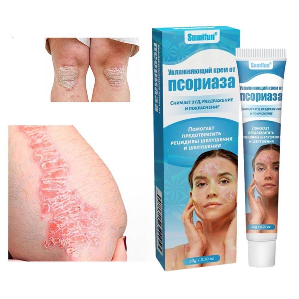 Therapeutic Skin Cream 20 ml – Moisturizing and Soothing for Psoriasis, Dermatitis & Eczema #6