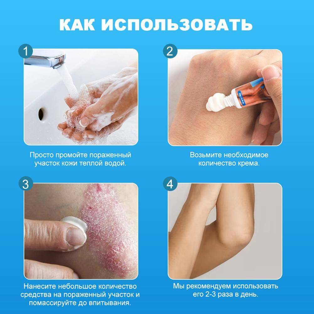 Therapeutic Skin Cream 20 ml – Moisturizing and Soothing for Psoriasis, Dermatitis & Eczema #11