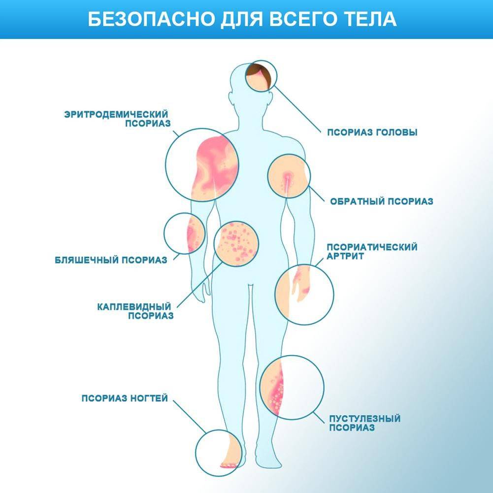 Therapeutic Skin Cream 20 ml – Moisturizing and Soothing for Psoriasis, Dermatitis & Eczema #10