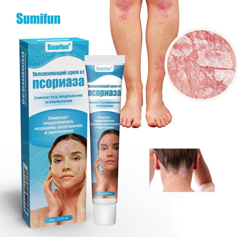 Therapeutic Skin Cream 20 ml – Moisturizing and Soothing for Psoriasis, Dermatitis & Eczema #4