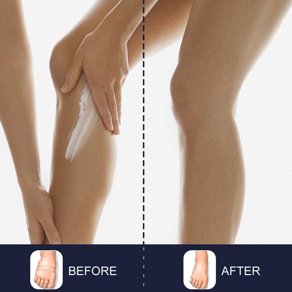 FOLLNSI Blue Ointment for Leg Swelling Relief #9