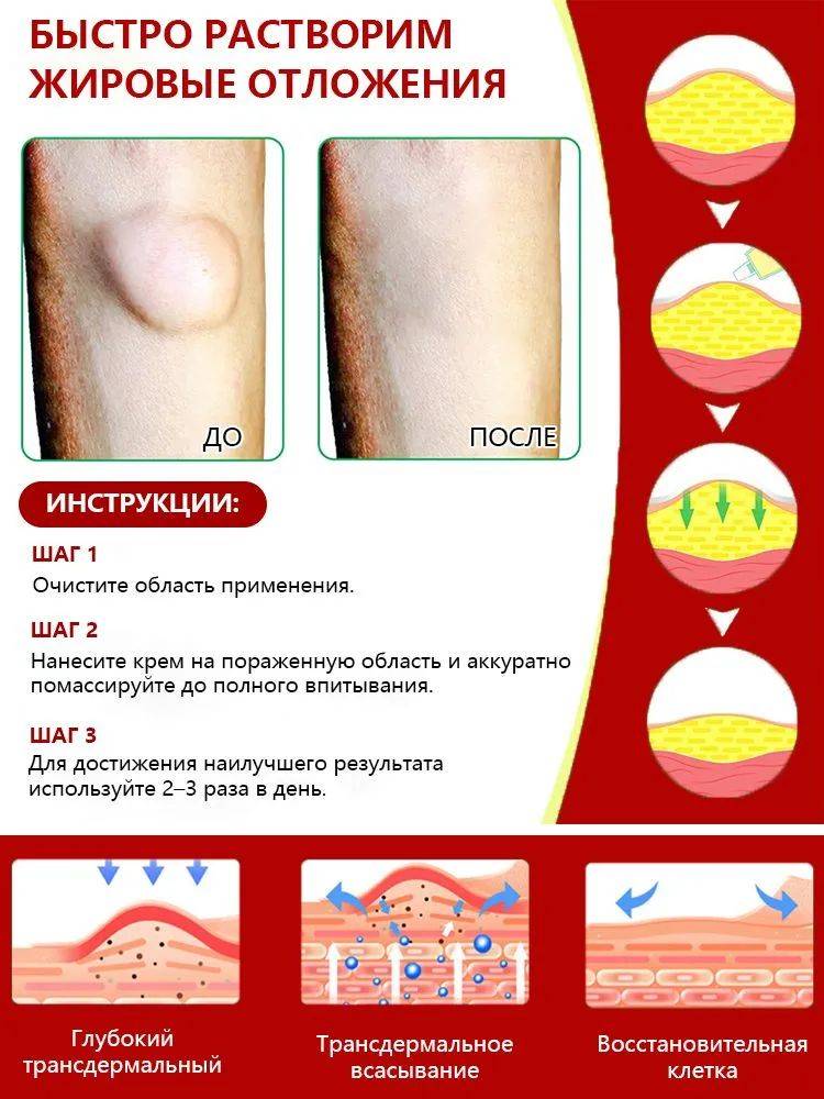 OKQI Lipoma Removal Ointment 30ml #6