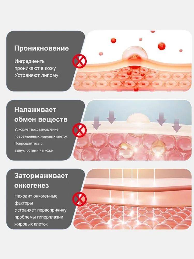 OKQI Lipoma Removal Ointment 30ml #9