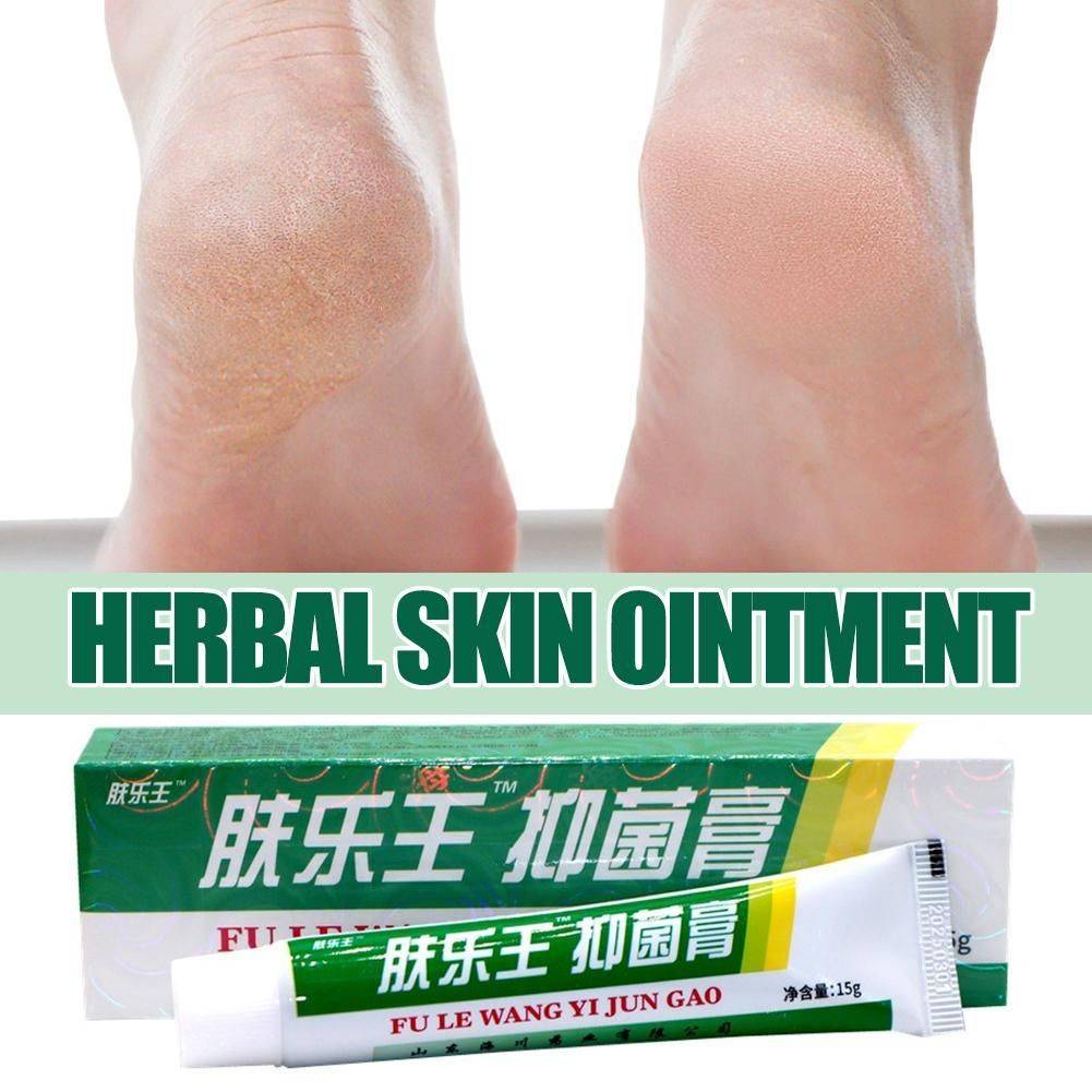 15ml Psoriasis Eczema Dermatitis Cream - Antimicrobial Skin Treatment #3