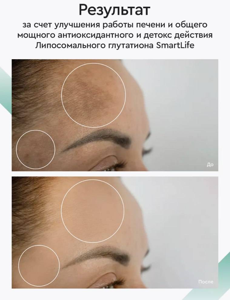 SMARTLIFE Liposomal Glutathione 100 ml x 2 bottles Dietary Supplement #11