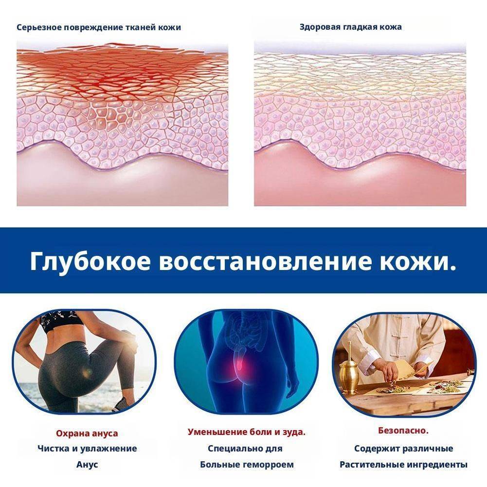 Hemorrhoid Relief Cream 30 g #11