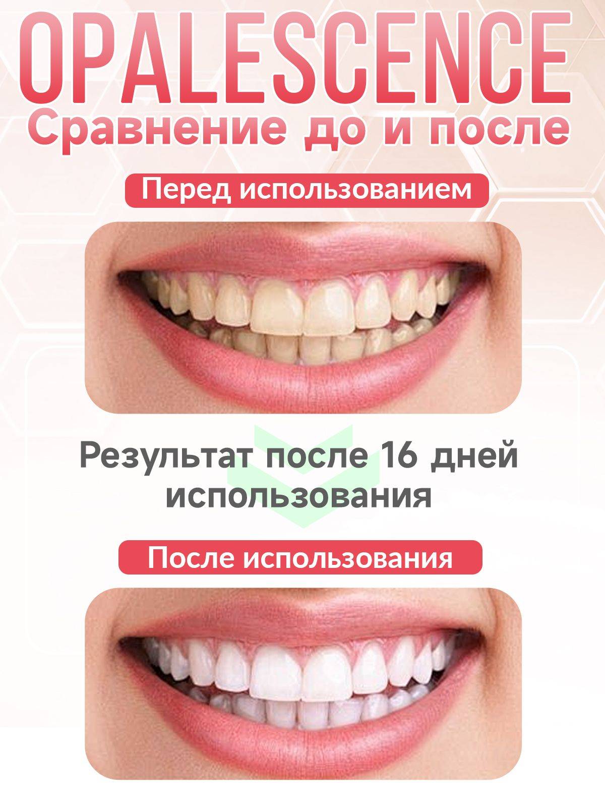 Opalescence PF 10% Home Teeth Whitening Gel Refill Kit (Pumpkin Flavor, 8 Syringes) #3