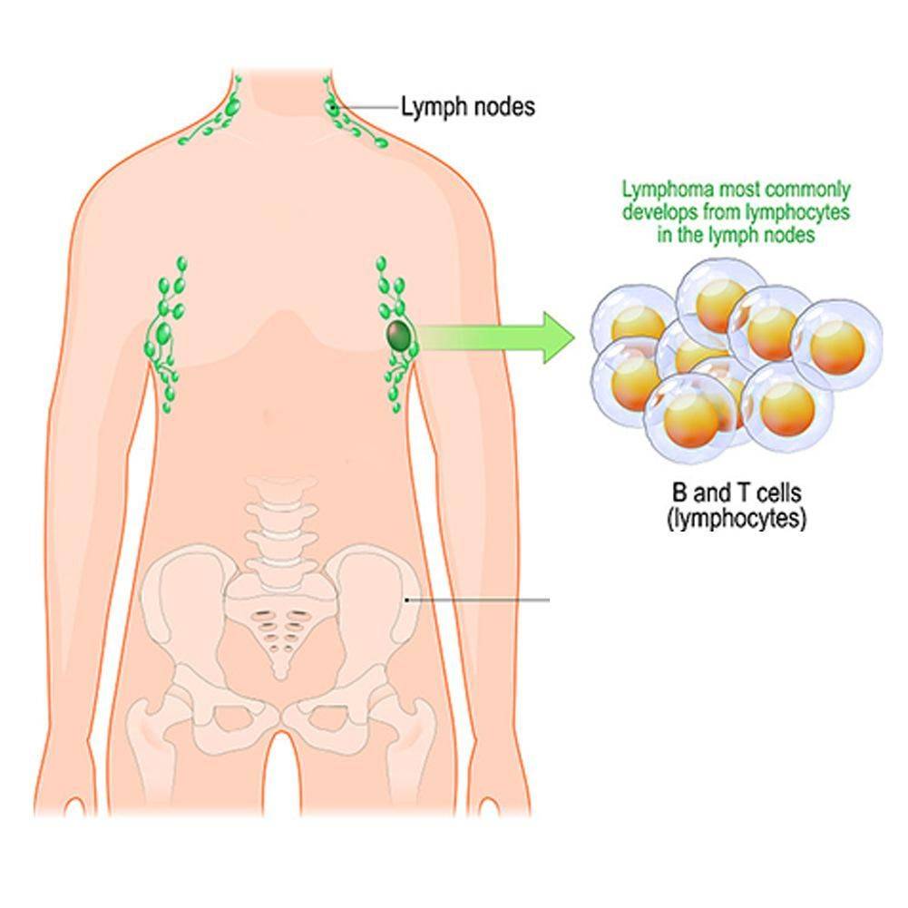 Harmonious 8‑Piece Thermoplastic Lymphatic Drainage Patch Pack – Light Blue #6