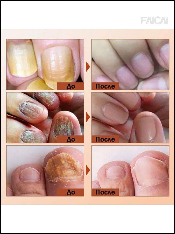 Therapeutic Agent 30 ml (1 Pack) #10