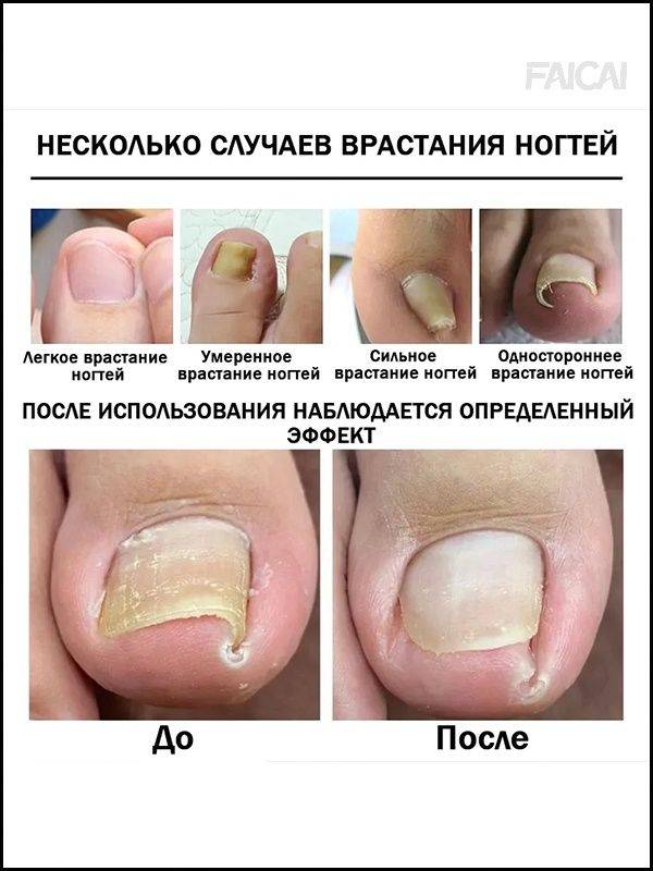 Therapeutic Agent 30 ml (1 Pack) #4