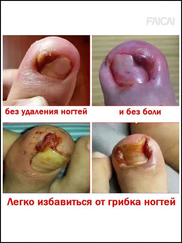 Therapeutic Agent 30 ml (1 Pack) #6