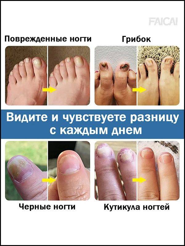 Therapeutic Agent 30 ml (1 Pack) #5