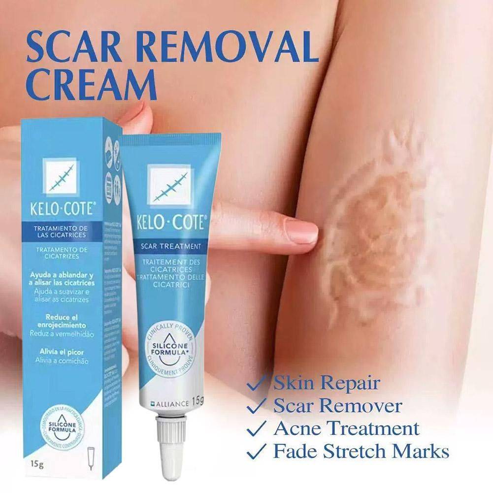 15 g Scar & Stretch Mark Healing Cream – Facial & Body Care #4