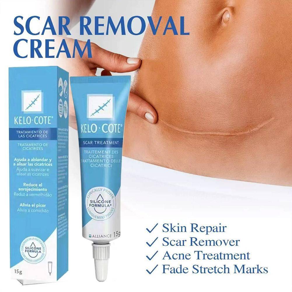 15 g Scar & Stretch Mark Healing Cream – Facial & Body Care #3