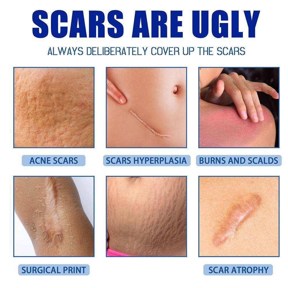 15 g Scar & Stretch Mark Healing Cream – Facial & Body Care #14