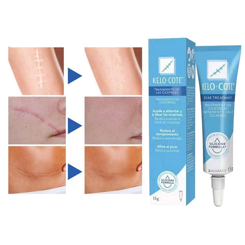 15 g Scar & Stretch Mark Healing Cream – Facial & Body Care #5