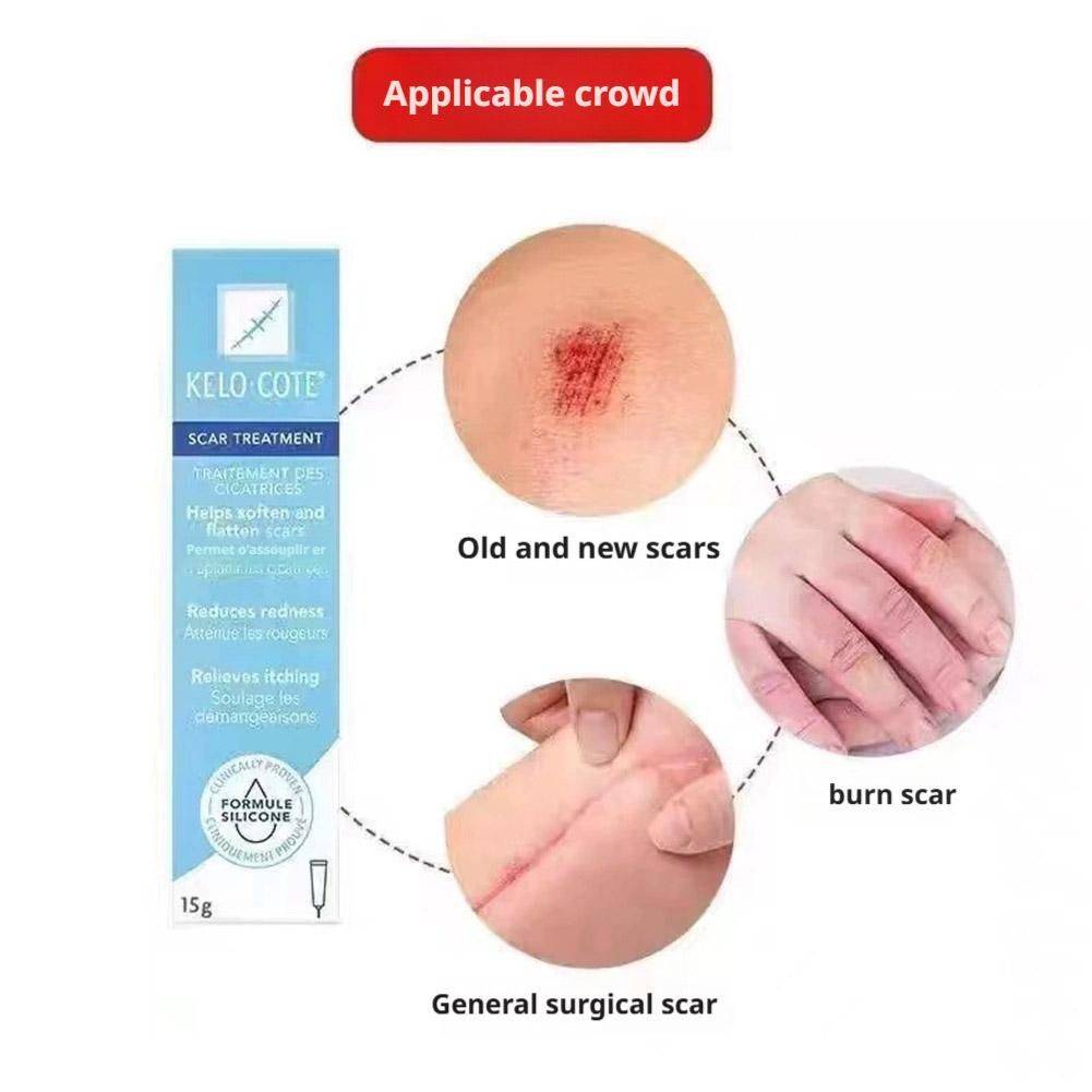 15 g Scar & Stretch Mark Healing Cream – Facial & Body Care #9