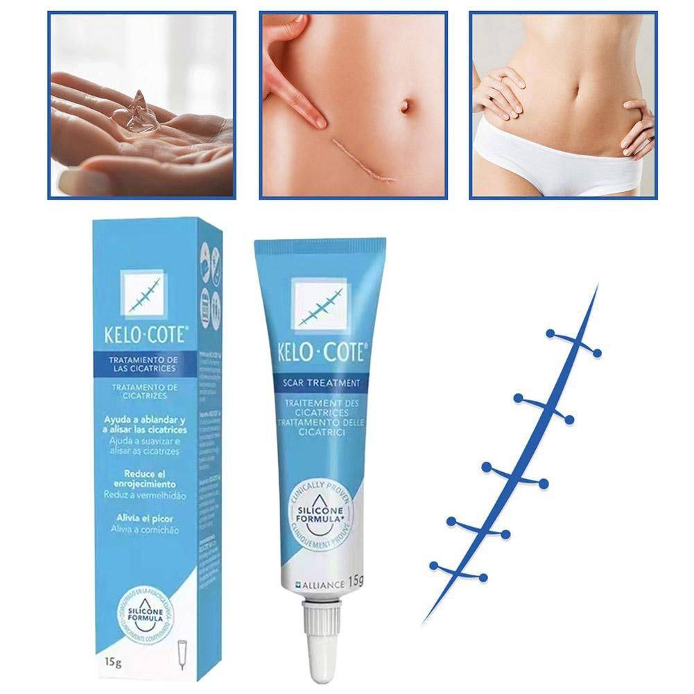 15 g Scar & Stretch Mark Healing Cream – Facial & Body Care #7