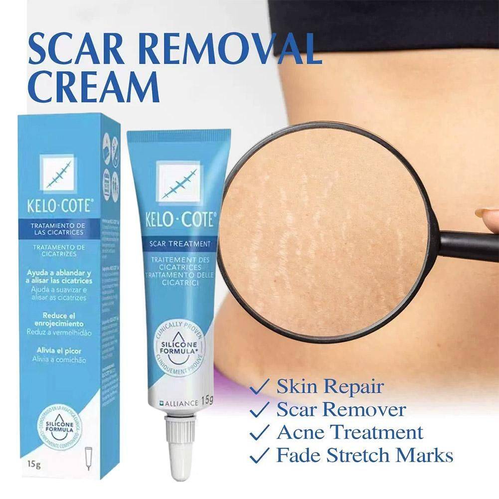 15 g Scar & Stretch Mark Healing Cream – Facial & Body Care #2