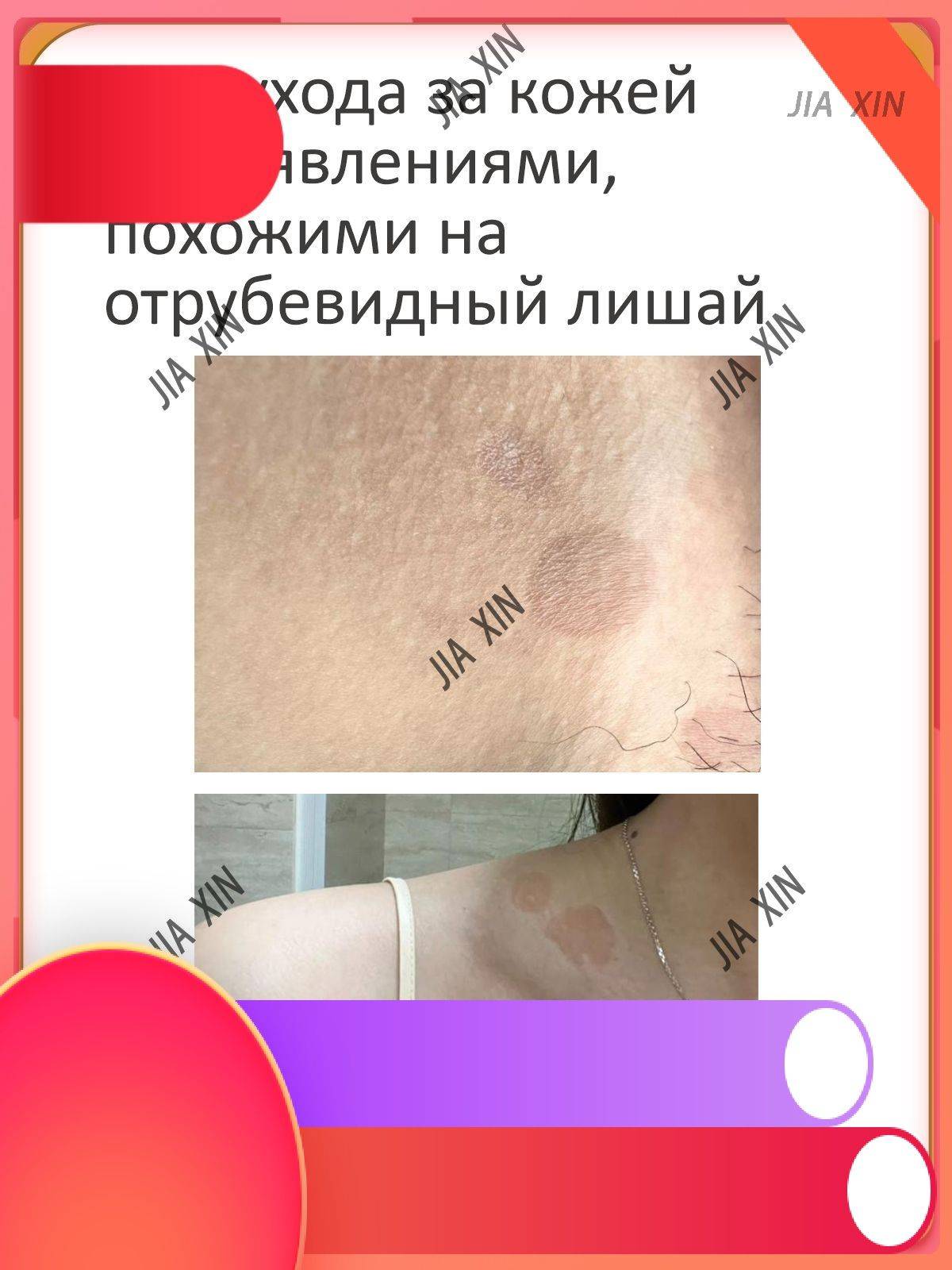 Ansin Ointment 20 ml Transparent for Dermatitis and Skin Irritation #3