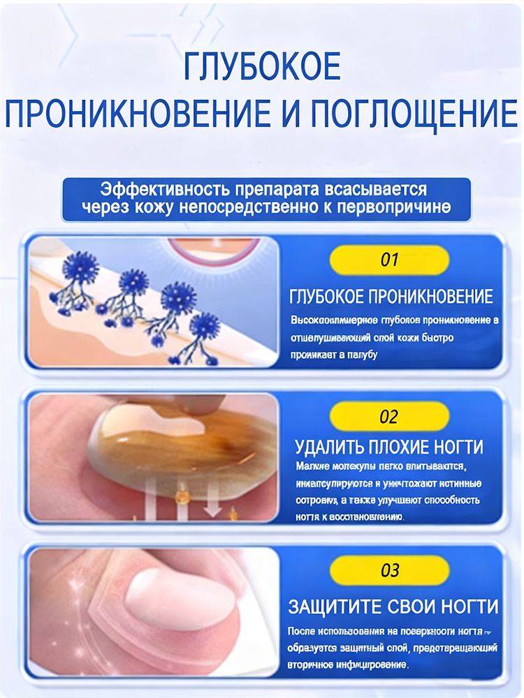 Antifungal Cream for Nail Restoration, Itch Relief, and Health, 20g #6