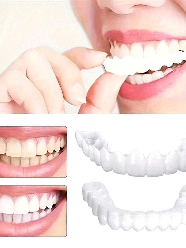 Temporary Decorative Braces Set – Upper and Lower Teeth #12