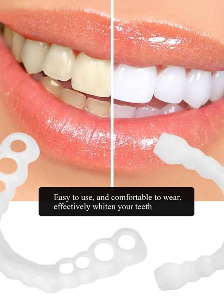 Temporary Decorative Braces Set – Upper and Lower Teeth #14