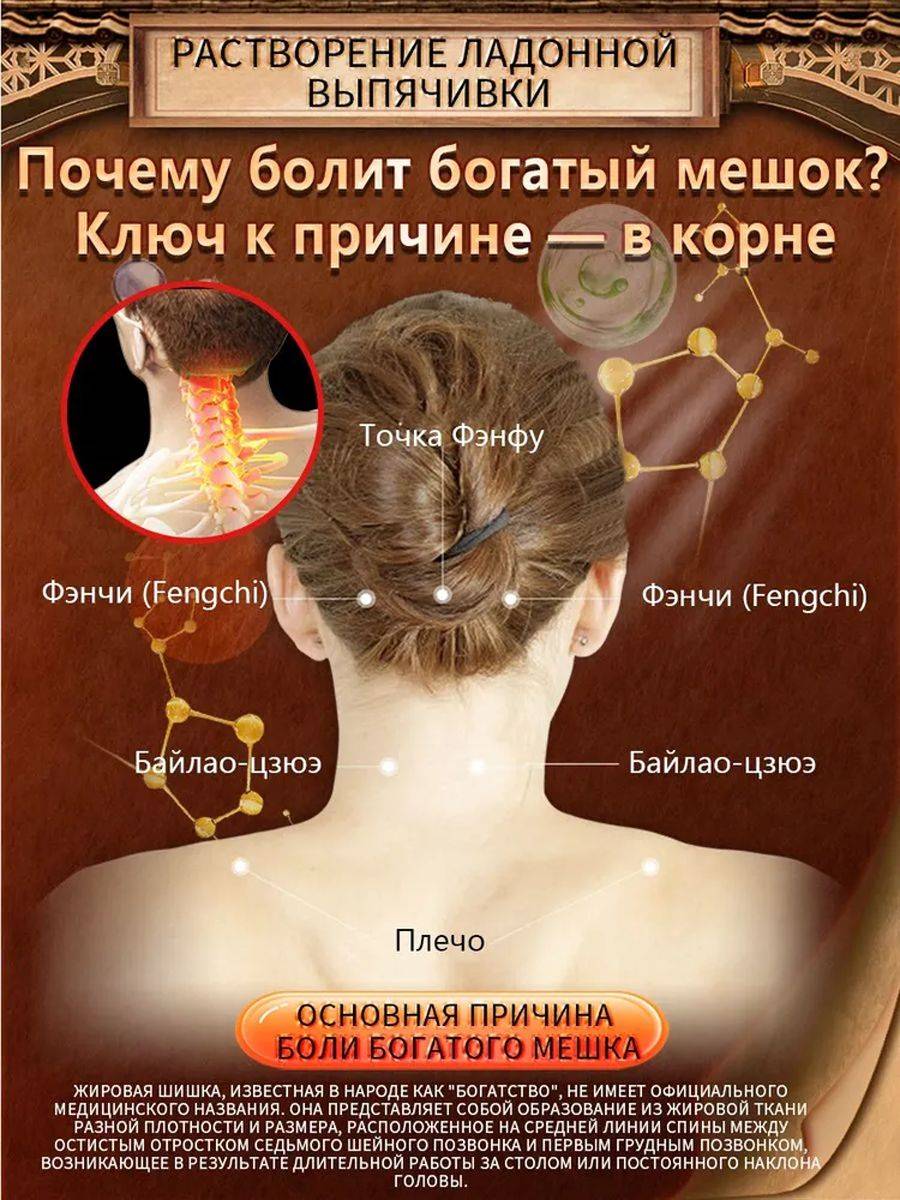 Neck Hump Relief Cream for Osteoarthritis and Back Pain, 20g #2