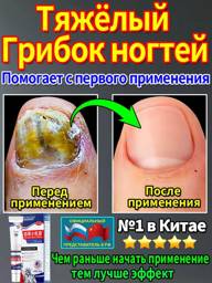 Nail Toke Ointment for Fungal Infections, Strengthen and Restore Nails and Skin, Eliminate Fungal Infections on Toenails #1