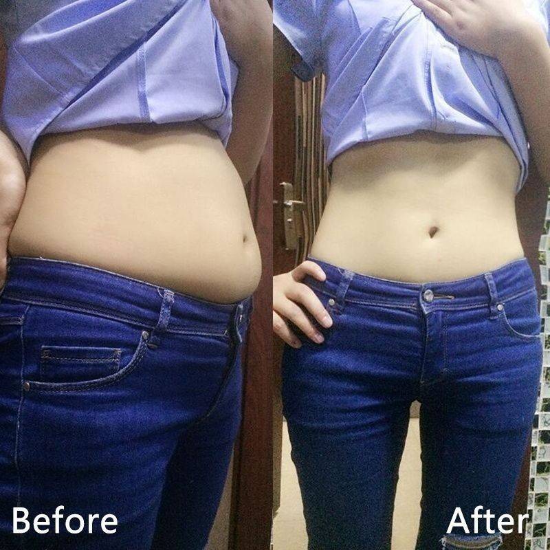 10-Piece Waist-Slimming Fat-Burning Ointment Patches for Belly Fat #3