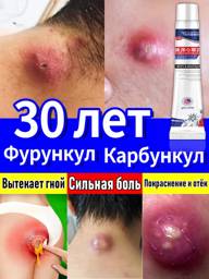 Vishnevsky Ointment for Fungal Infections, Acne, and Abscesses 20g #1