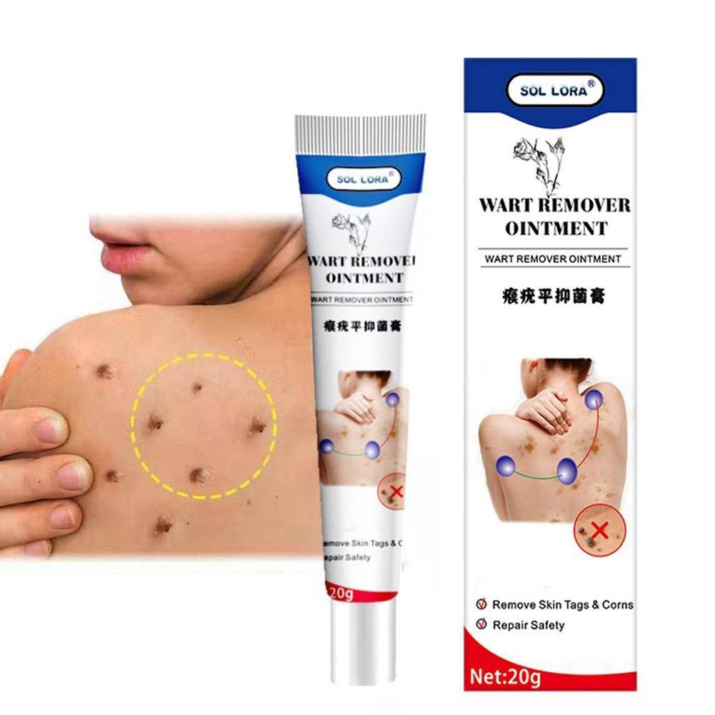 WartRemoval Cream 20g Pain-Free Solution for Sensitive Skin #3
