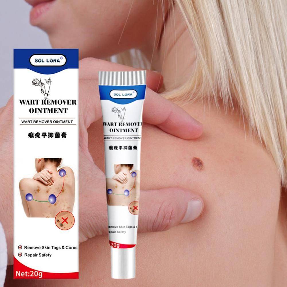 WartRemoval Cream 20g Pain-Free Solution for Sensitive Skin #6