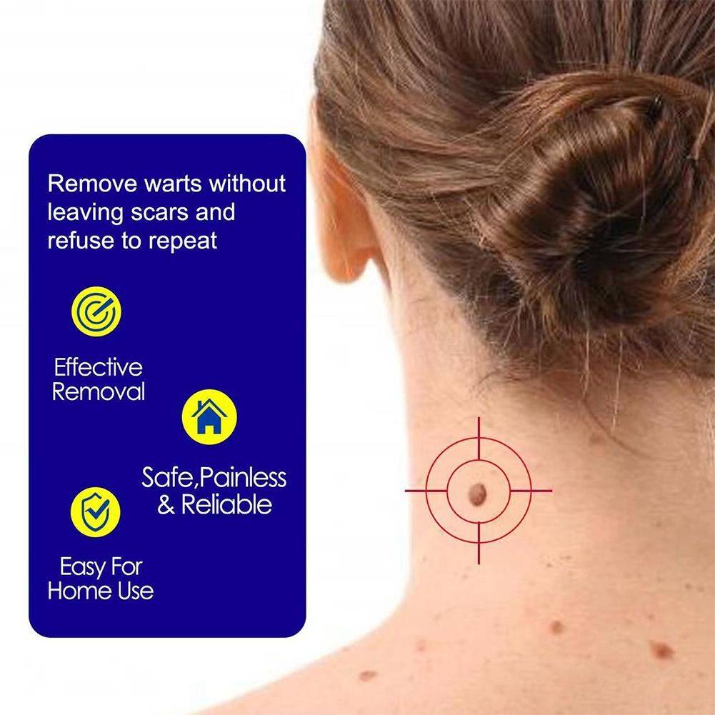 WartRemoval Cream 20g Pain-Free Solution for Sensitive Skin #10