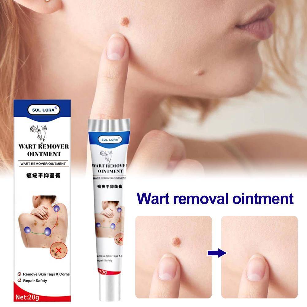 WartRemoval Cream 20g Pain-Free Solution for Sensitive Skin #5