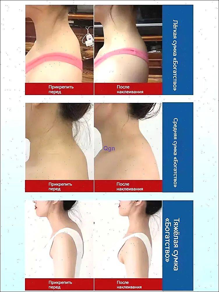 Neck Support Posture Correction Patch – 20 pcs #9