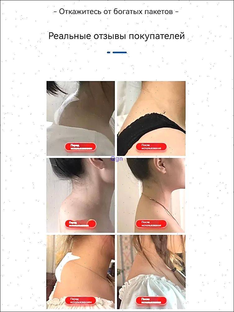 Neck Support Posture Correction Patch – 20 pcs #3