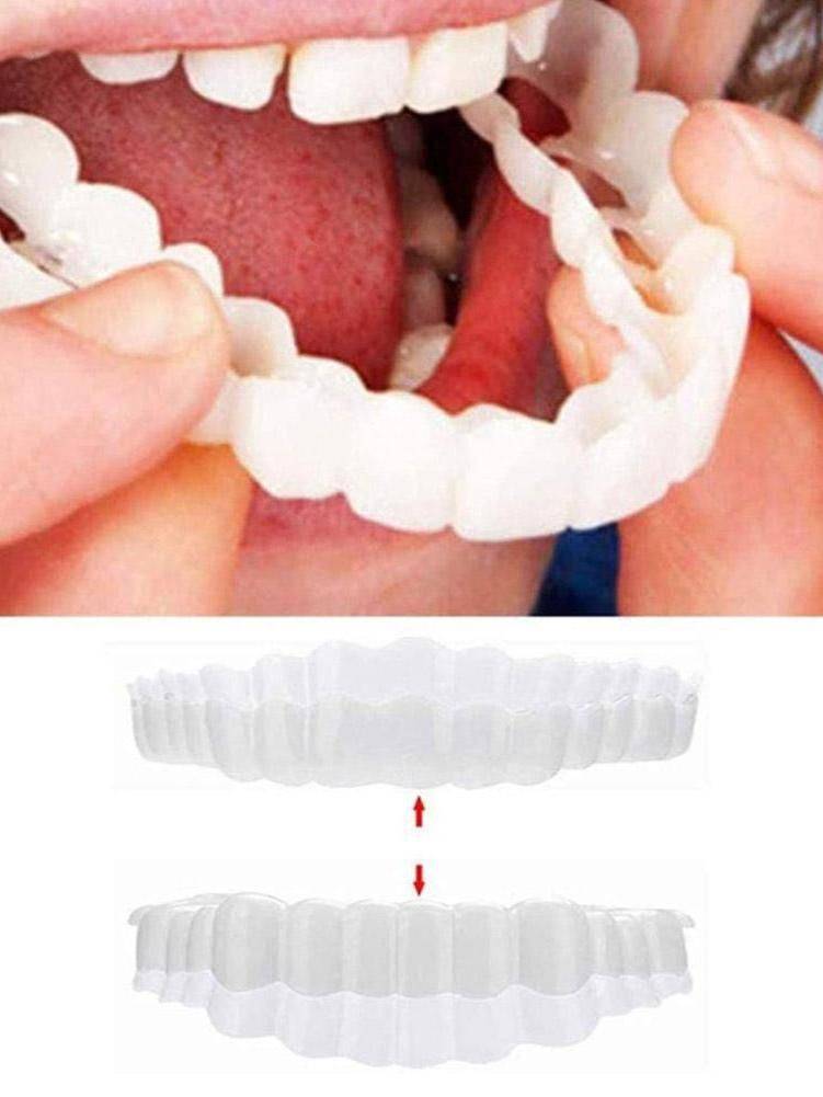 Temporary Decorative Braces Set – Upper and Lower Teeth #2
