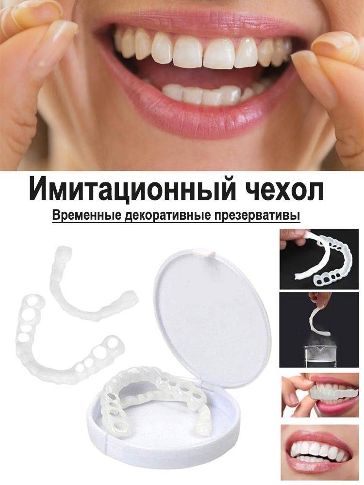 Temporary Decorative Braces Set – Upper and Lower Teeth #5