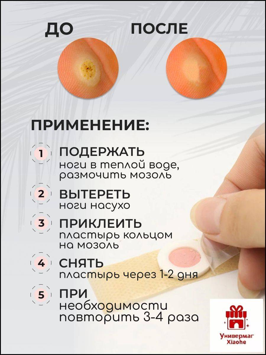 Xiaohe Dry Corn and Callus Plaster 2cm x 7cm #5