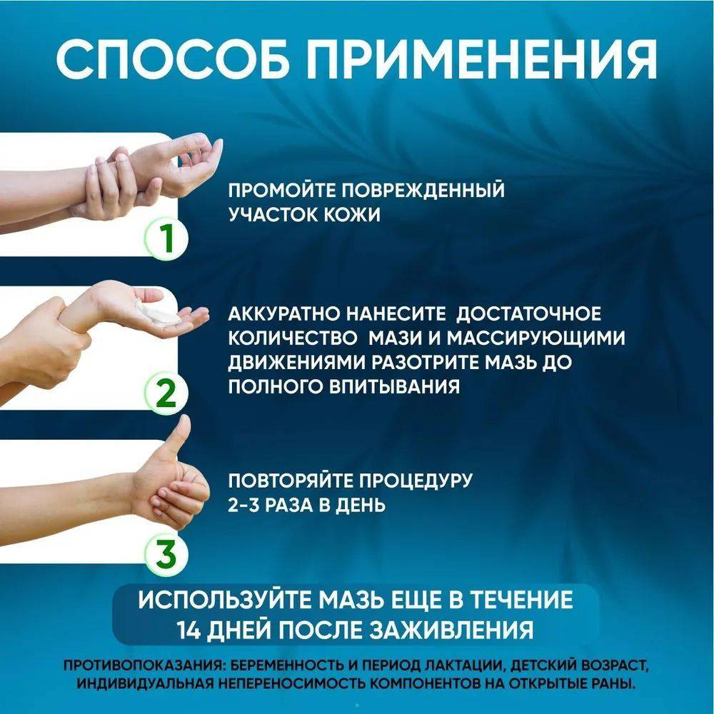 Therapeutic Skin Cream for Psoriasis – Antibacterial, Anti‑Inflammatory – 90 g Tube (3 pcs) #6