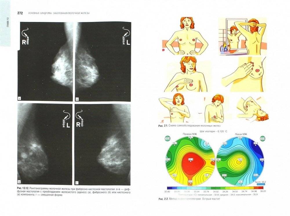 Маммология. Национальное руководство фото книги 2